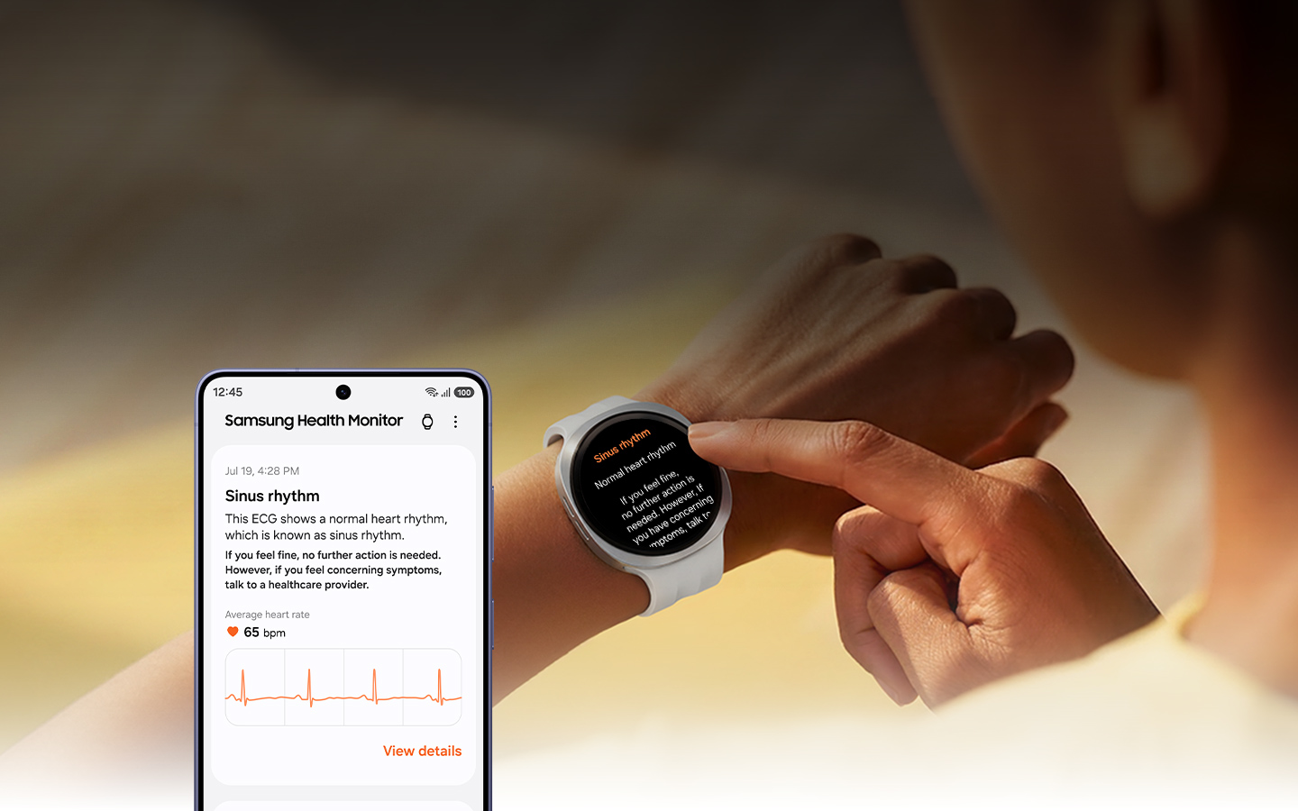 Une femme interagit avec sa Galaxy Watch. La montre affiche une lecture d’électrocardiogramme (ECG) en rythme sinusal, incluant le texte « Rythme cardiaque normal » et des analyses associées en bas. Un smartphone Samsung Health Monitor avec les détails du rythme sinusal et le graphique affichés à l’écran est montré à proximité.